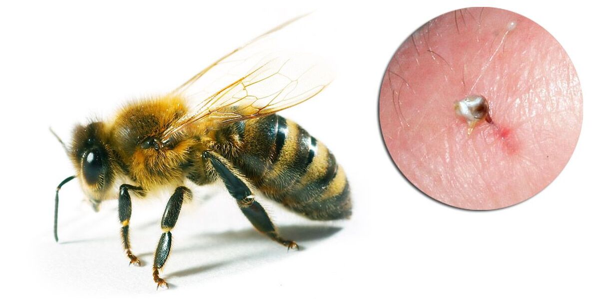 Hondrostrong, toxumalardakı metabolik prosesləri yaxşılaşdıran arı zəhərini ehtiva edir