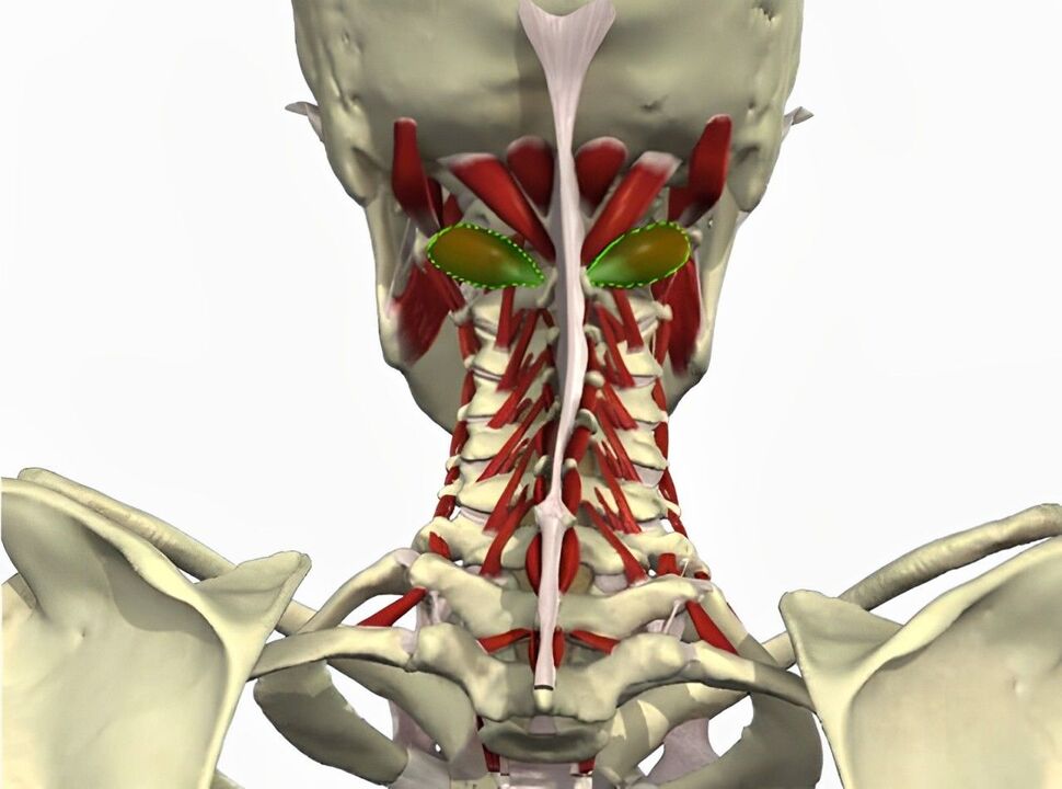 vertebral arteriya sindromu