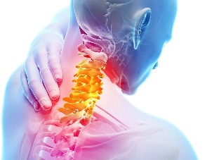 Boyun osteochondrosis